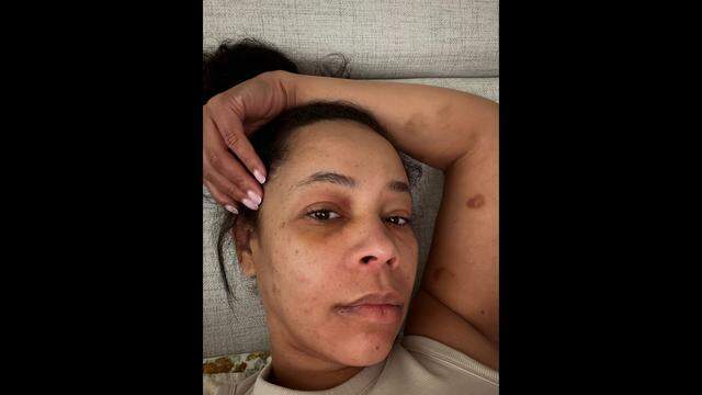 Taneisha Thompson was treated at a hospital after a Hurst police officer pulled her from her car following a traffic stop. Thompson recorded her interaction with the police on video.